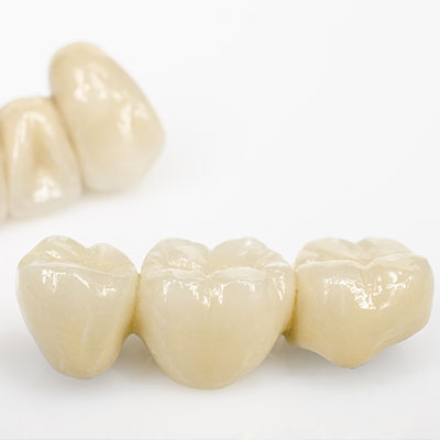 crowns