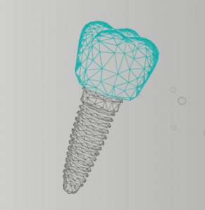 implant